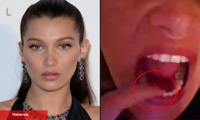Bella Hadid'in paylaşımı hayranlarını üzdü! "Tedavisi olmayan acılar çekiyorum"