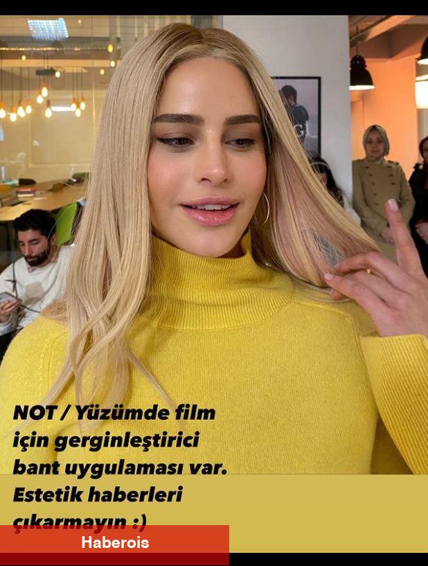 Büşra Pekin yüzüne estetik mi yaptı? Ünlü oyuncu gerçeği birinci sefer açıkladı