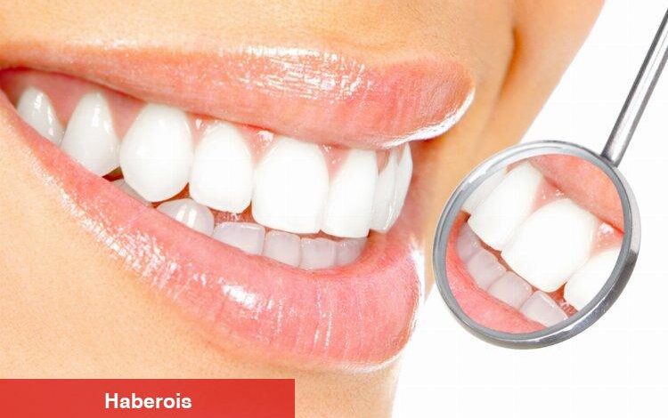 Diş beyazlatma kalıcı çözüm değil - Haberois Diş beyazlatma kalıcı çözüm değil