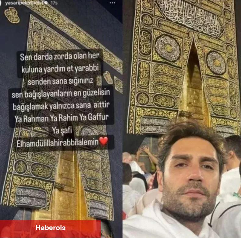 Yaşar İpek'in yeni imajı olay oldu! Çene estetiği yaptıran ünlü müzikçi...