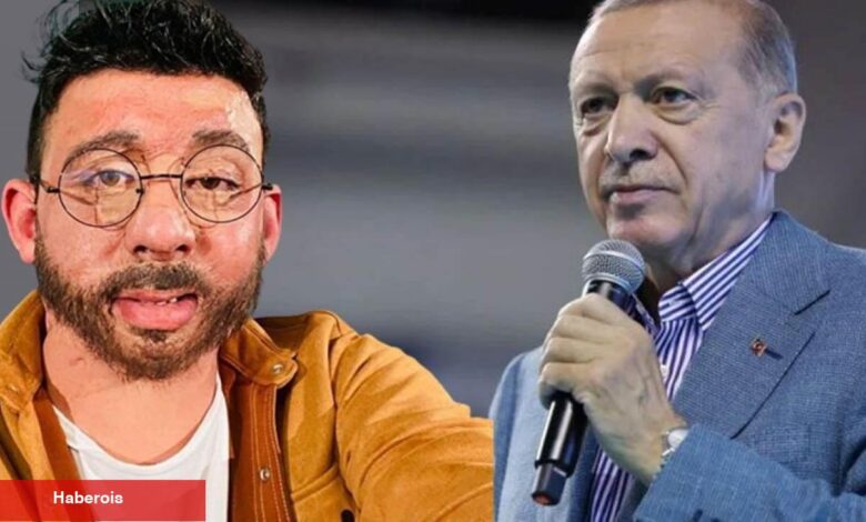 Cumhurbaşkanı Erdoğan sayesinde hayatı değişti! Bedeninin %70'i yanan Gökhan Baran... - Haberois Cumhurbaşkanı Erdoğan sayesinde hayatı değişti! Bedeninin %70'i yanan Gökhan Baran...