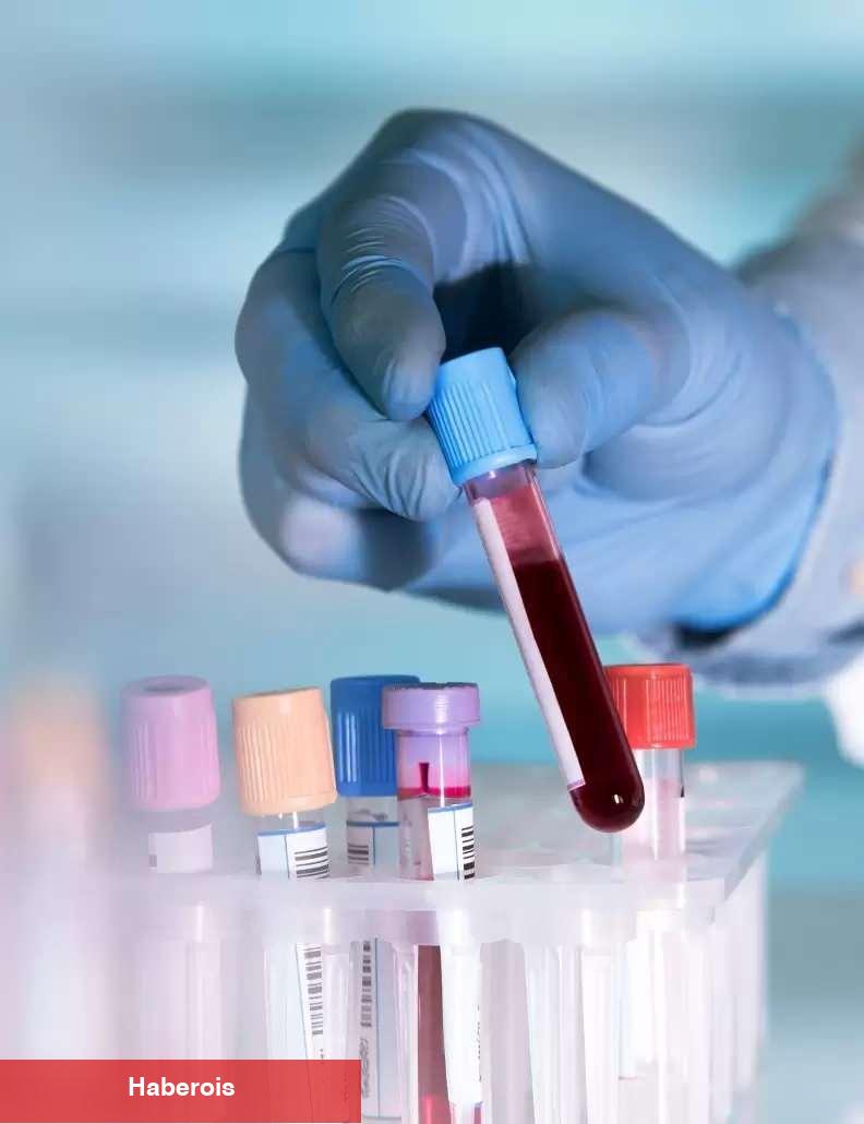 Evlilik öncesi tarama testi nedir? Akdeniz anemisiyle çabayı kolaylaştırıyor