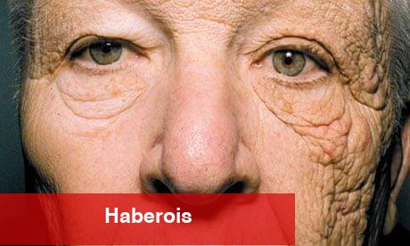 Güneş kremi kullanmanın değeri nedir? Kullanmazsak ne üzere yan tesirlere maruz kalırız? - Haberois Güneş kremi kullanmanın değeri nedir? Kullanmazsak ne üzere yan tesirlere maruz kalırız?