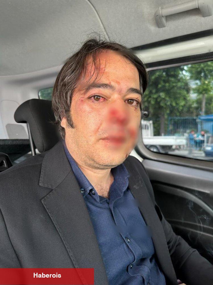 İstanbul Büyükşehir ekiplerine 'yıkım' saldırısı... 3 darp, 1 yaralı!