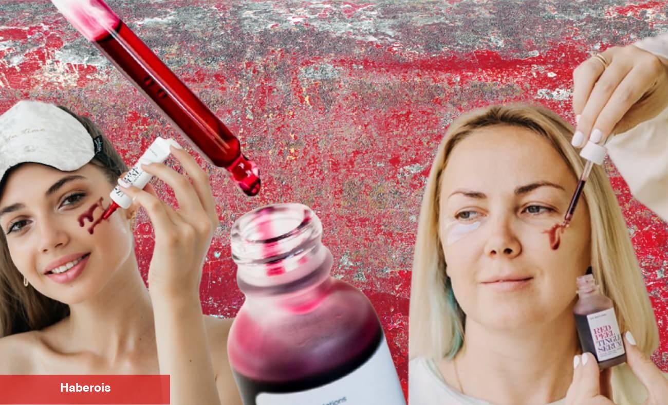 Kırmızı peeling nedir ve nasıl uygulanır? Kırmızı Peeling ne işe fayda?
