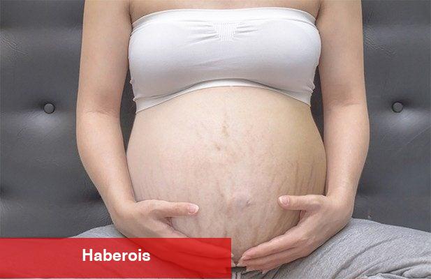 Hamilelikte çatlak oluşumu nasıl önlenir? - Haberois Hamilelikte çatlak oluşumu nasıl önlenir?