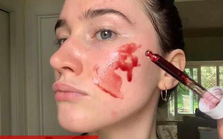 Kırmızı peeling ne işe fayda? - Haberois Kırmızı peeling ne işe fayda?