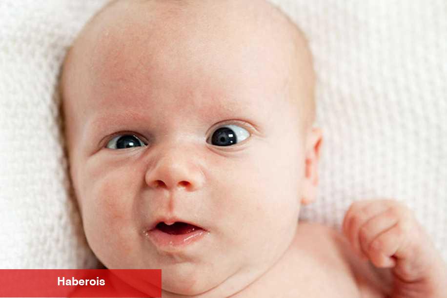 A vitamini eksikliği