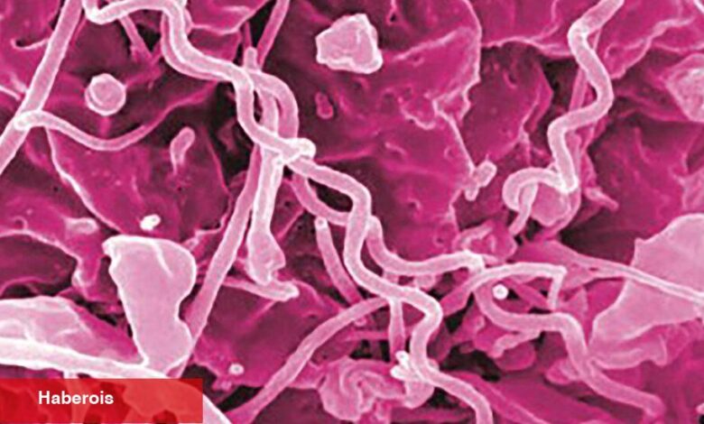 Antibiyotik Eksikliği Frengi Salgınını Kötüleştirebilir - Haberois Antibiyotik Eksikliği Frengi Salgınını Kötüleştirebilir