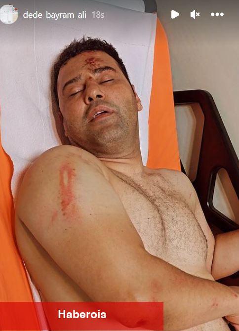 Survivor Hikmet Tuğsuz sokak ortasında başcazgıra sopayla saldırdı! Manzaralar pes dedirtti