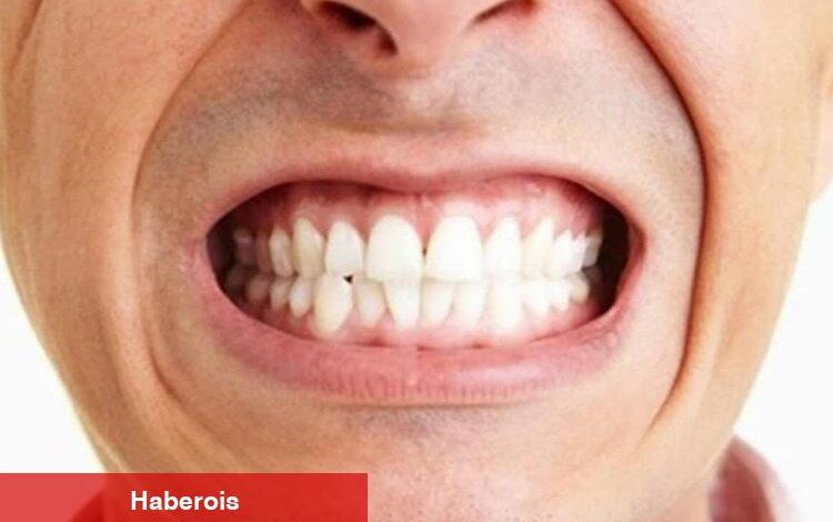 Diş sıkma problemini önemseyin! - Haberois Diş sıkma problemini önemseyin!