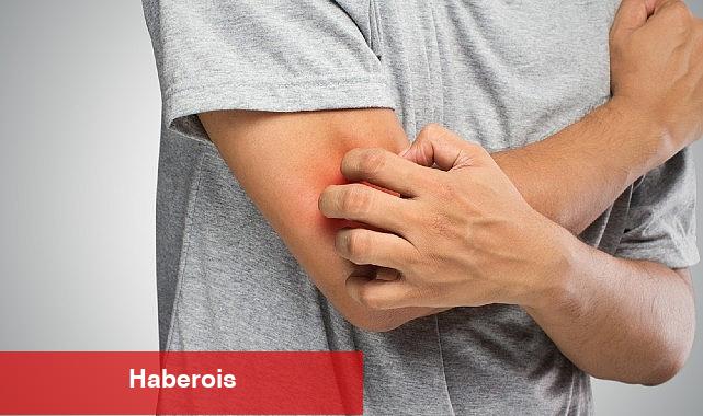 Mantar Hastalığı Hakkında Bilinmesi Gereken 6 Önemli Bilgi! - Haberois Mantar Hastalığı Hakkında Bilinmesi Gereken 6 Önemli Bilgi!