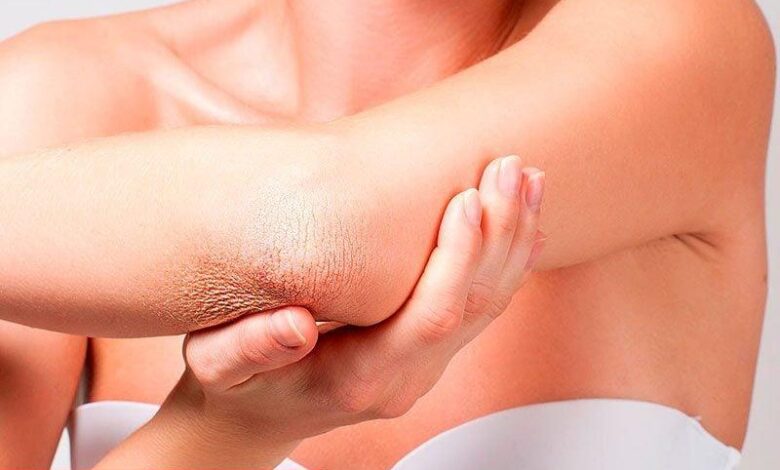 Sağlıklı ve pürüzsüz dirsekler için ipuçları - Haberois Sağlıklı ve pürüzsüz dirsekler için ipuçları