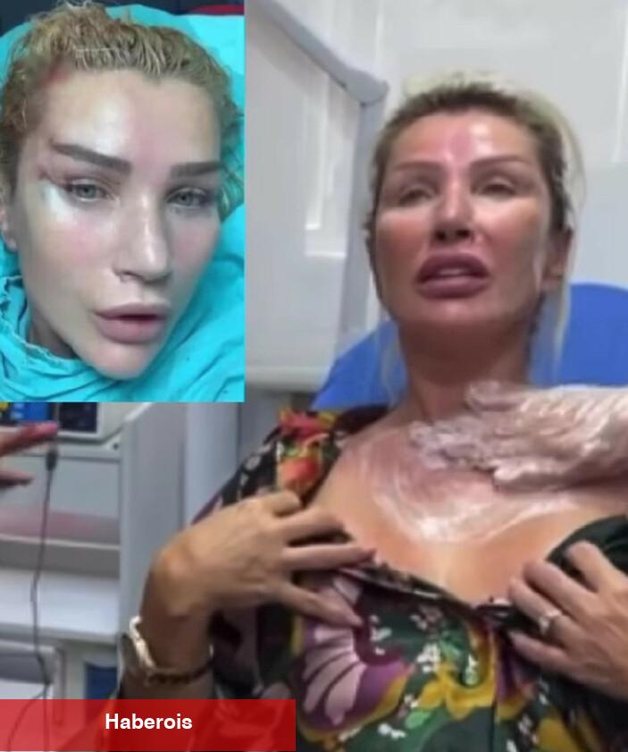 Seda Sayan yeni estetiğini paylaştı!