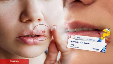 Aklovir krem nedir, ne işe fayda? Aklovir krem kullanımı! Aklovir krem fiyatı 2023