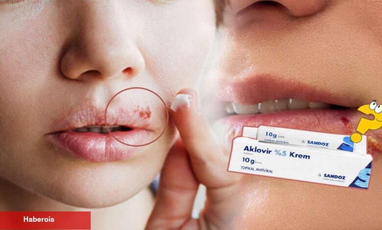 Aklovir krem nedir, ne işe fayda? Aklovir krem kullanımı! Aklovir krem fiyatı 2023 - Haberois Aklovir krem nedir, ne işe fayda? Aklovir krem kullanımı! Aklovir krem fiyatı 2023