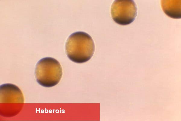 CDC, Menenjite Neden Olan Bakterilerin Yeniden Yayıldığı Uyarısında Bulundu - Haberois CDC, Menenjite Neden Olan Bakterilerin Yeniden Yayıldığı Uyarısında Bulundu