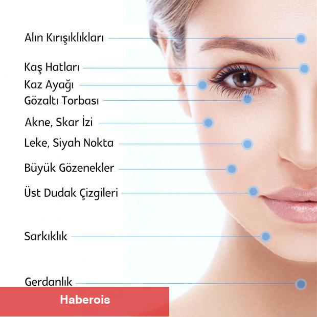 Dermapen nasıl uygulanır? Kaç seans sürer? Dermapen uygulamasının fiyatları 2024