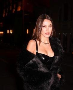 Dilan Çiçek Deniz estetiklerini eritti!