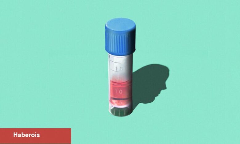 'Fetal Kişilik' Neden Sağa Dönüyor? - Haberois 'Fetal Kişilik' Neden Sağa Dönüyor?