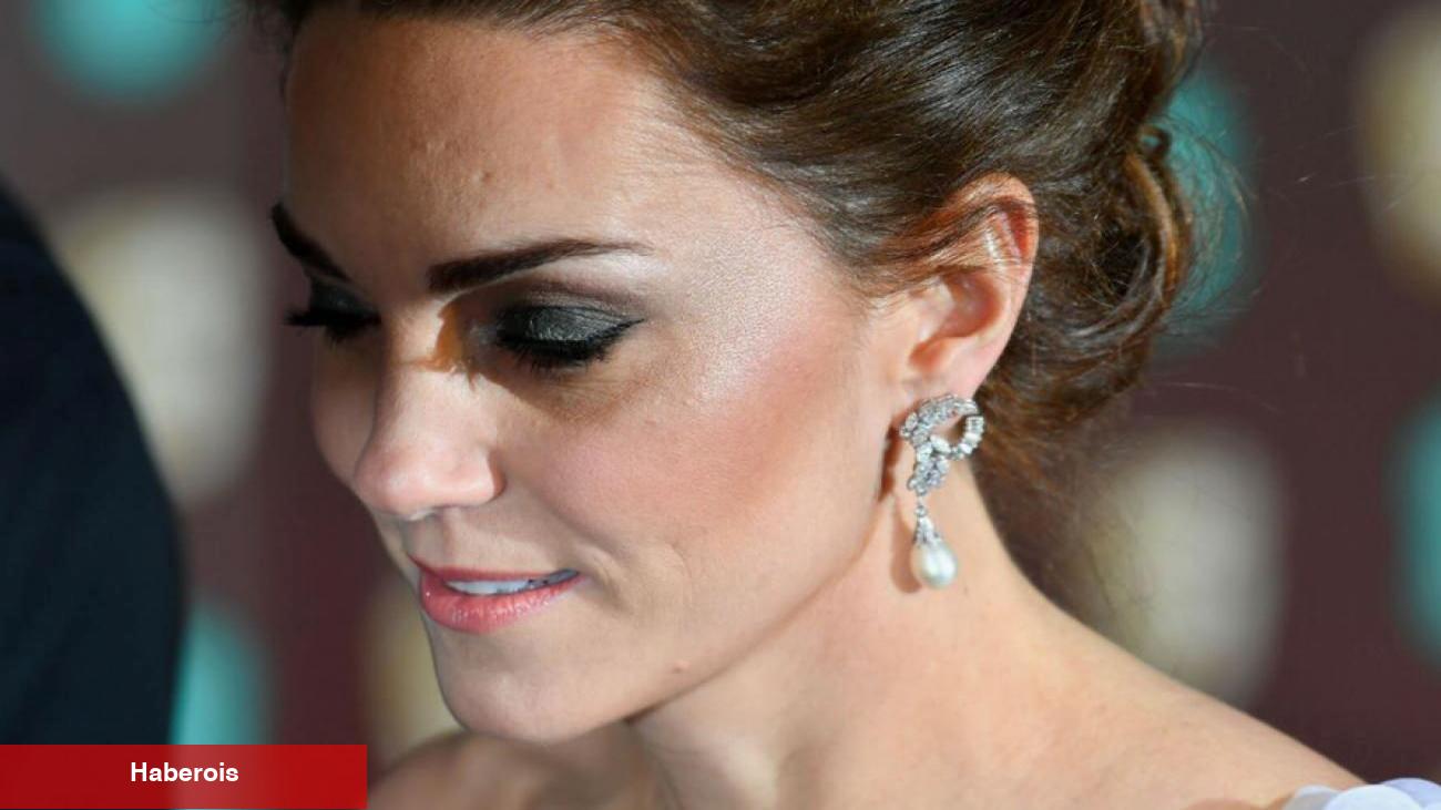 Kate Middleton'ın sır üzere saklanan hastalığı ne? Kimse ikna olmuyor
