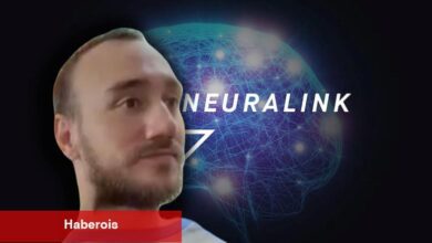 Neuralink'in Beynine Çip Taktığı Kişinin Birinci Görüntüsü Paylaşıldı [Video]