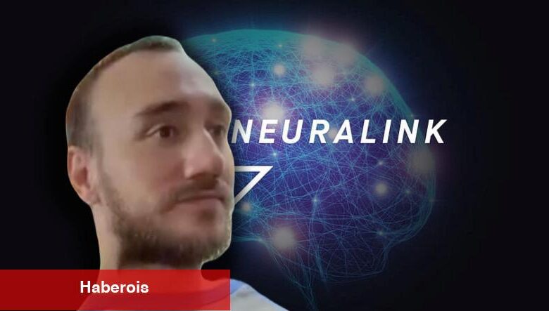 Neuralink'in Beynine Çip Taktığı Kişinin Birinci Görüntüsü Paylaşıldı [Video]