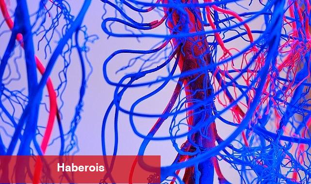 Damar Tikanıklarını Önlemenin 7 Etkili Yolu! - Haberois Damar Tikanıklarını Önlemenin 7 Etkili Yolu!