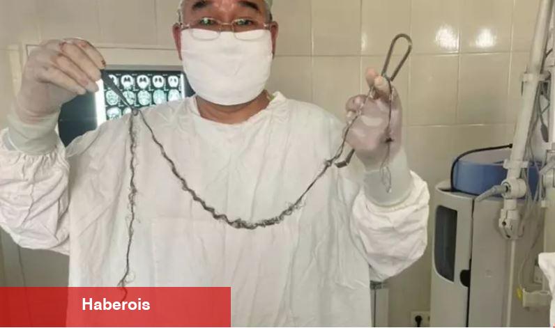 Tıp dünyası şokta! Kırgızistanlı çocuğun beyninden çıkan şaşırttı