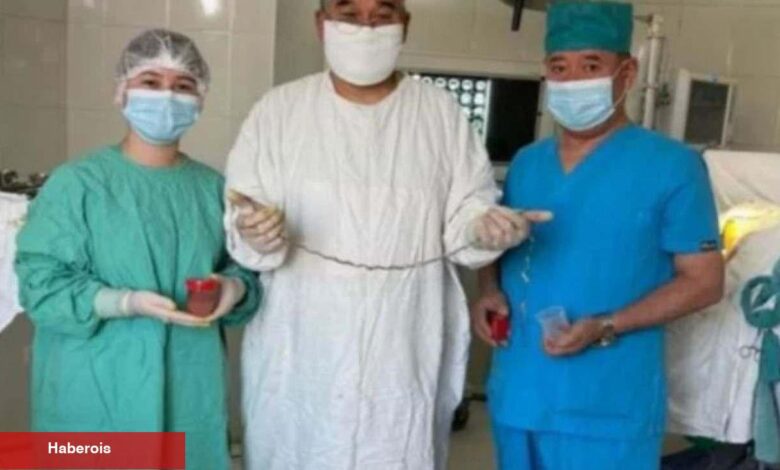 Tıp dünyası şokta! Kırgızistanlı çocuğun beyninden çıkan şaşırttı - Haberois Tıp dünyası şokta! Kırgızistanlı çocuğun beyninden çıkan şaşırttı