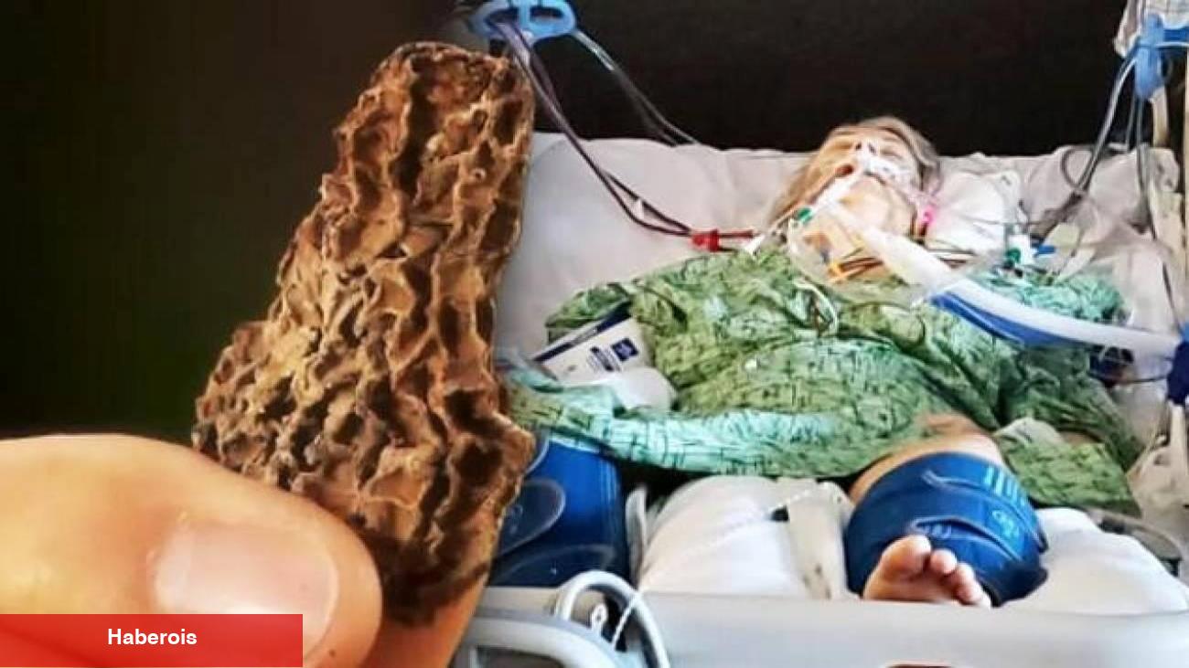 Yediği öğlen yemeği sonu oldu! 64 yaşındaki bayanın hayatına mal olan sebep bakın neymiş