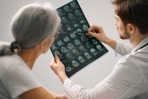 Alzheimer’ı erken fark edin!