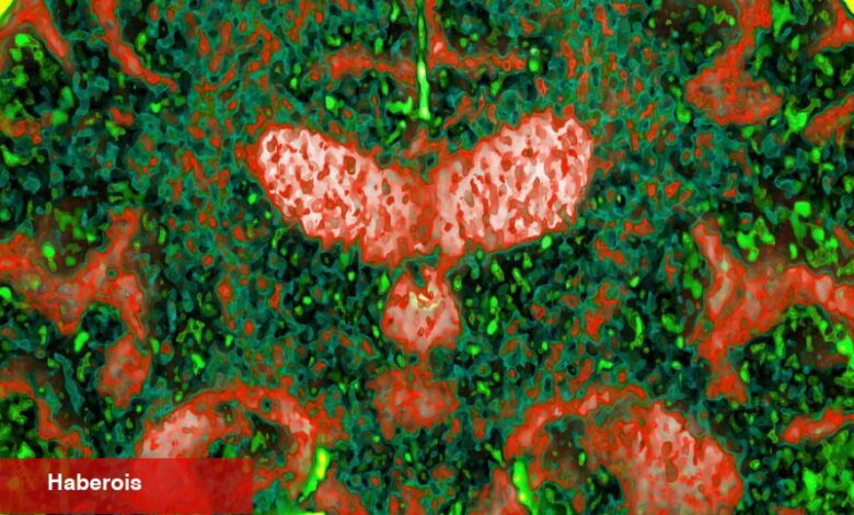 Çalışma, Genetiğin Bazı Alzheimerlar İçin Sadece Bir Risk Değil, Bir Sebep Olduğunu Öneriyor - Haberois Çalışma, Genetiğin Bazı Alzheimerlar İçin Sadece Bir Risk Değil, Bir Sebep Olduğunu Öneriyor