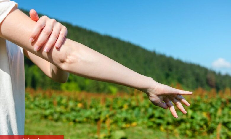 Doğal yolla sivrisinekleri uzak tutun! - Haberois Doğal yolla sivrisinekleri uzak tutun!