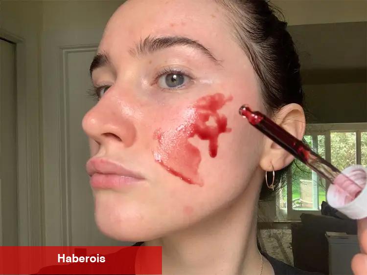 Kırmızı peeling ne işe fayda? Kullanırken neden dikkat edilmeli?