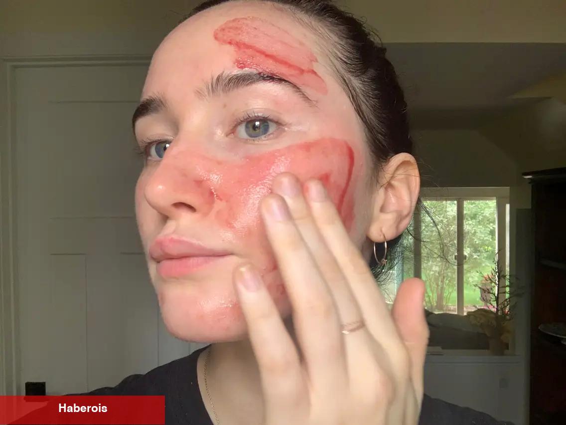 Kırmızı peeling ne işe fayda? Kullanırken neden dikkat edilmeli?