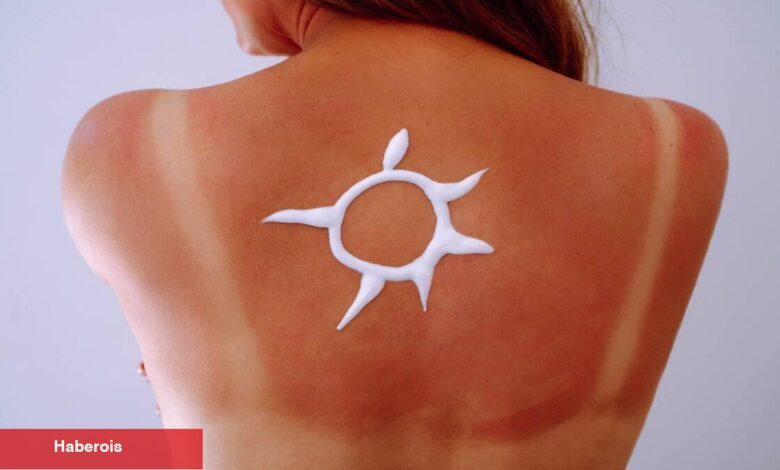Bu usulle mayo ve bikini izlerinden kurtulun! - Haberois Bu usulle mayo ve bikini izlerinden kurtulun!