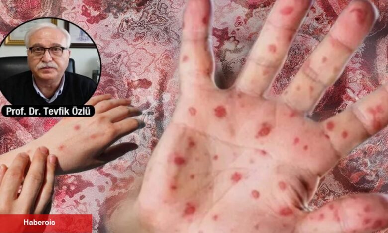 Maymun çiçeği virüsünde toplu taşımalara dikkat! 'Salgınlarla yaşamaya alışılmalı' - Haberois Maymun çiçeği virüsünde toplu taşımalara dikkat! 'Salgınlarla yaşamaya alışılmalı'