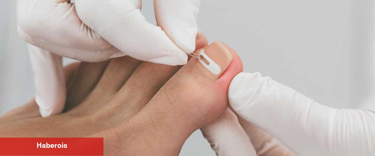 Tırnak batmasını önlemenin sırları: Hakikat tırnak bakımı