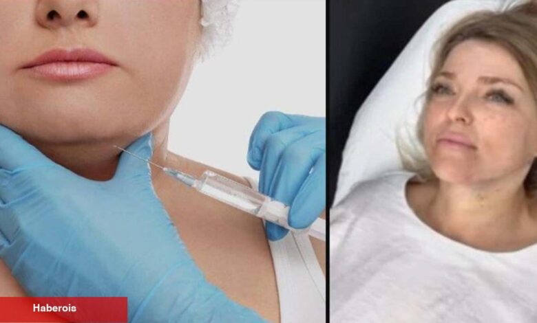 Geçirdiği operasyonla farklı biri oldu! O operasyon tartışmaların odağında - Haberois Geçirdiği operasyonla farklı biri oldu! O operasyon tartışmaların odağında