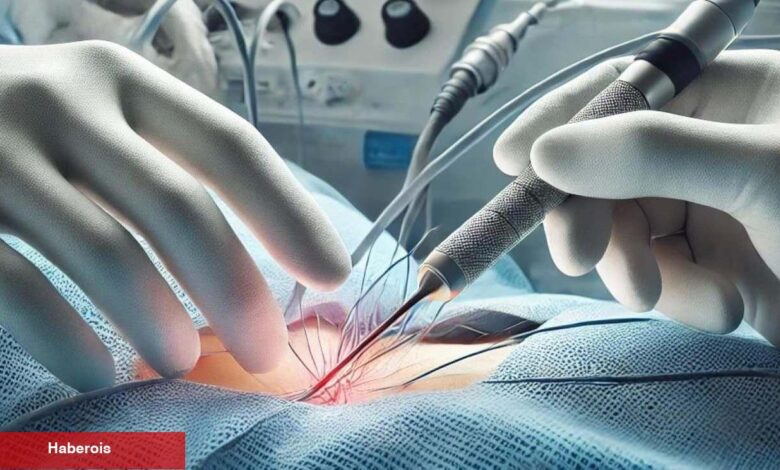 Kalp ritim bozukluğuna mucize üzere formül: Ablasyon tedavisi