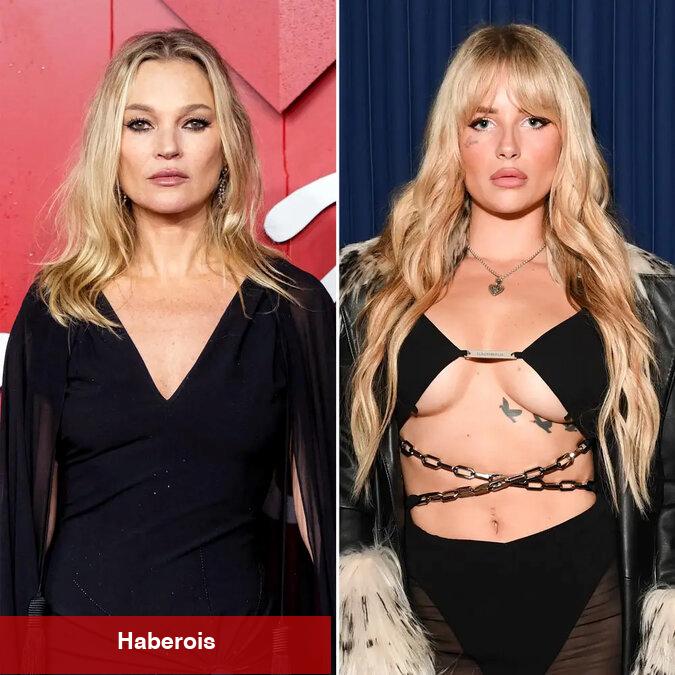 Lottie Moss: 'Yaşadığım en vahim tecrübelerden biriydi'