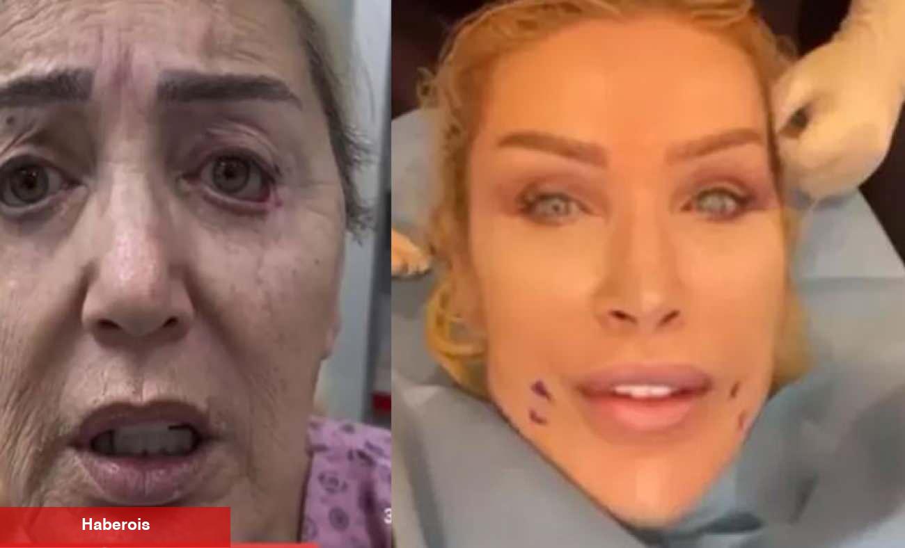 Seda Sayan'ın ablası resmen yüz nakli yaptırdı! Nursel Yıldız'ın son hali ortaya çıktı