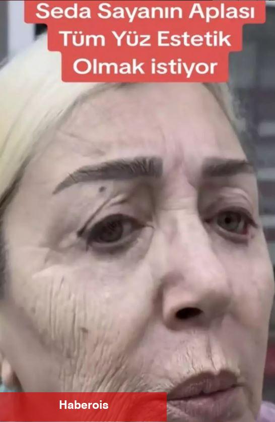 Seda Sayan'ın ablası resmen yüz nakli yaptırdı! Nursel Yıldız'ın son hali ortaya çıktı