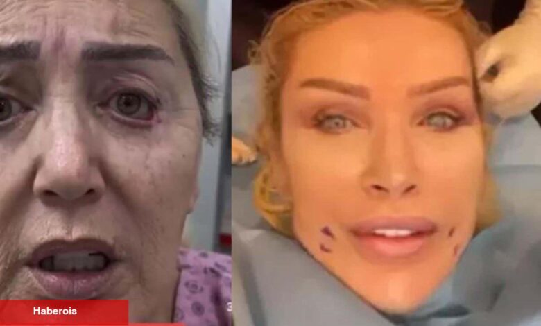 Seda Sayan'ın ablası resmen yüz nakli yaptırdı! Nursel Yıldız'ın son hali ortaya çıktı - Haberois Seda Sayan'ın ablası resmen yüz nakli yaptırdı! Nursel Yıldız'ın son hali ortaya çıktı