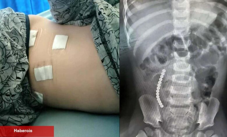 Öldüren TikTok akımı: 12 yaşındaki çocuk son anda kurtarıldı - Haberois Öldüren TikTok akımı: 12 yaşındaki çocuk son anda kurtarıldı