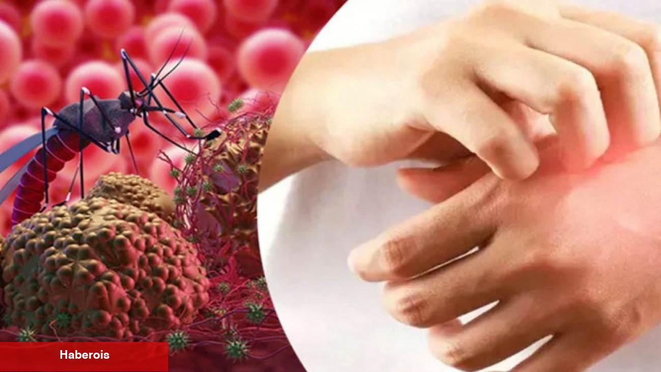 Seyahat edenler dikkat! Yüksek ateşle başlıyor vefata neden olan tehlike: Sıtma
