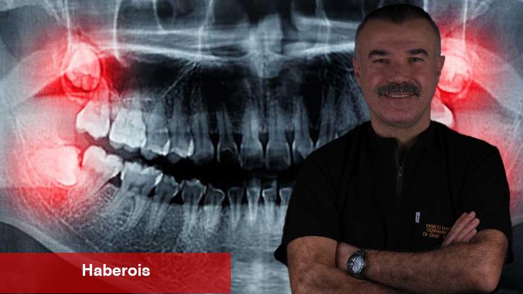 Yirmilik dişler ihmale gelmiyor!