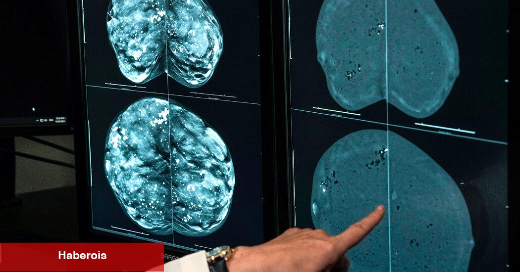 Bir tür mamogram yoğun göğüsleri olan kadınlar için daha iyi olur