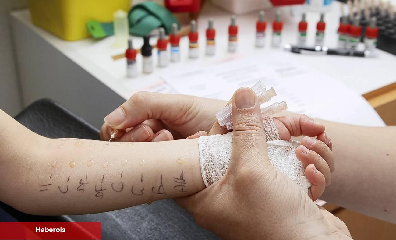 Çocuklarda alerji testi nasıl yapılır? Deri prick testi nedir?